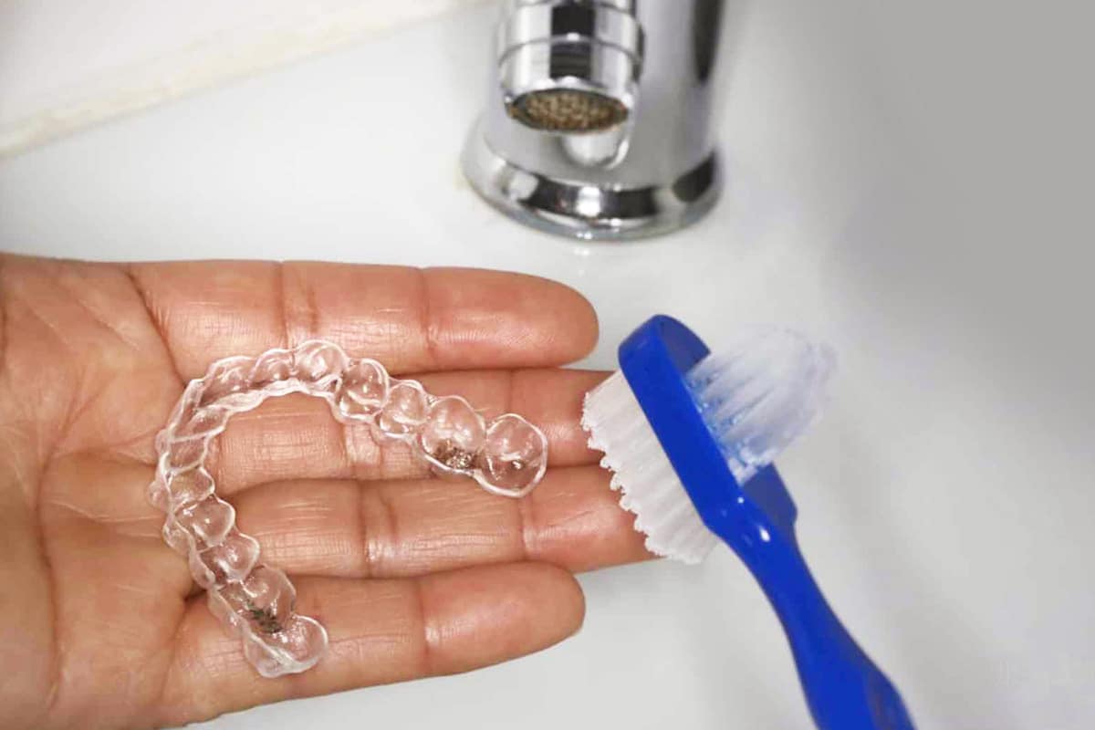 Daily Care for Your Invisalign Aligners