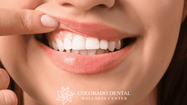 5 Ways Clear Braces Maintain Healthy Gums