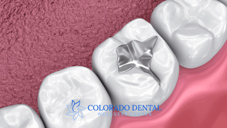 Get To Know The 5 Different Types of Dental fillings