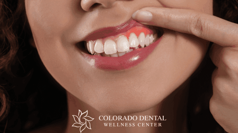 Gum Disease Prevention_ Simple Steps for Healthy Gums