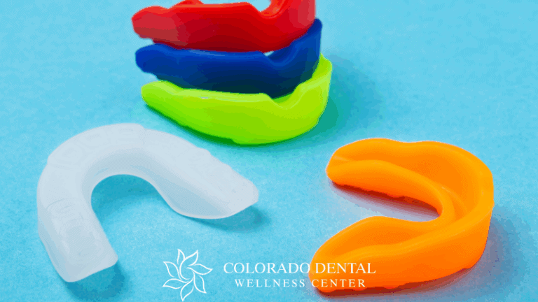 Mouth Guards_ Protecting Your Teeth During Sports