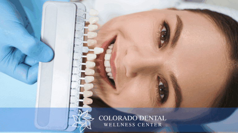 The Art of Veneers_ Achieving a Perfect Smile Makeover