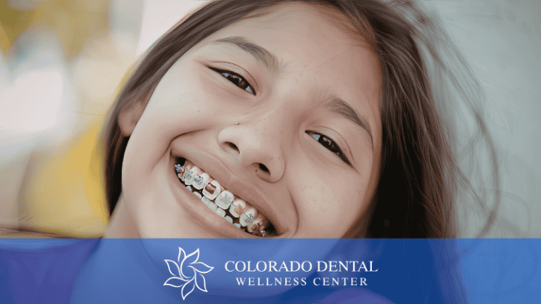 Crowded Teeth Are Not a Braces Problem